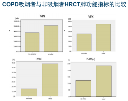 曾庆思教授：慢性阻塞性肺疾病的影像表现及研究进展