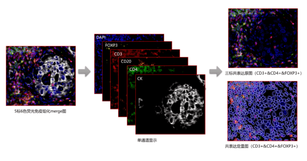 科研福音，思路迪多重荧光病理图像分析软件AP-TIME重磅上线