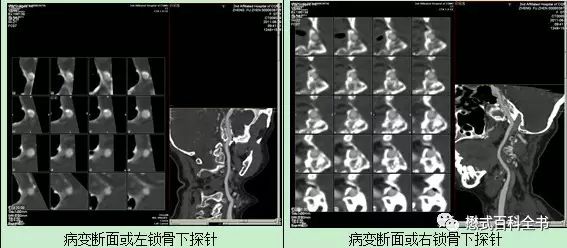 【转】CTA图像