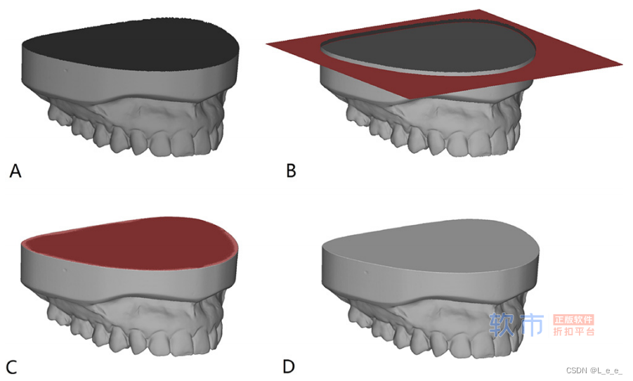 【论文笔记】Mapping intraoral photographs on virtual teeth model