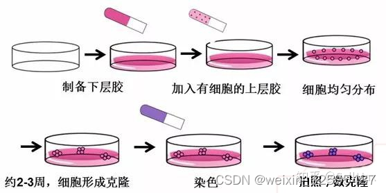 学位论文精读-hBMSCs在肿瘤微环境中分泌IL-6并上调IL-17水平协同促进DLBCL生长的研究