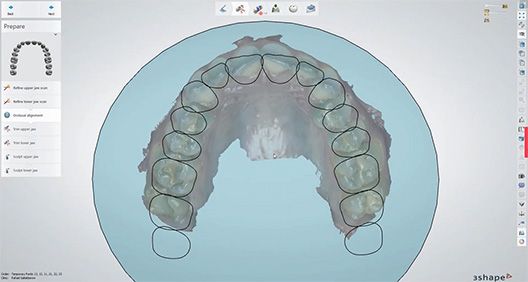 3Shape 牙科系统 2021.2 发布