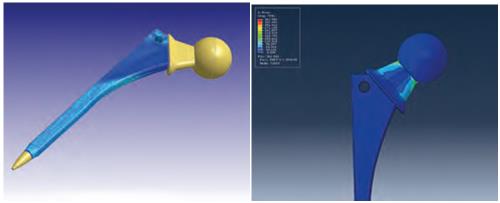 Moldex3D模流分析之案例分享：Moldex3D 提供医疗器材产品模流解决方案