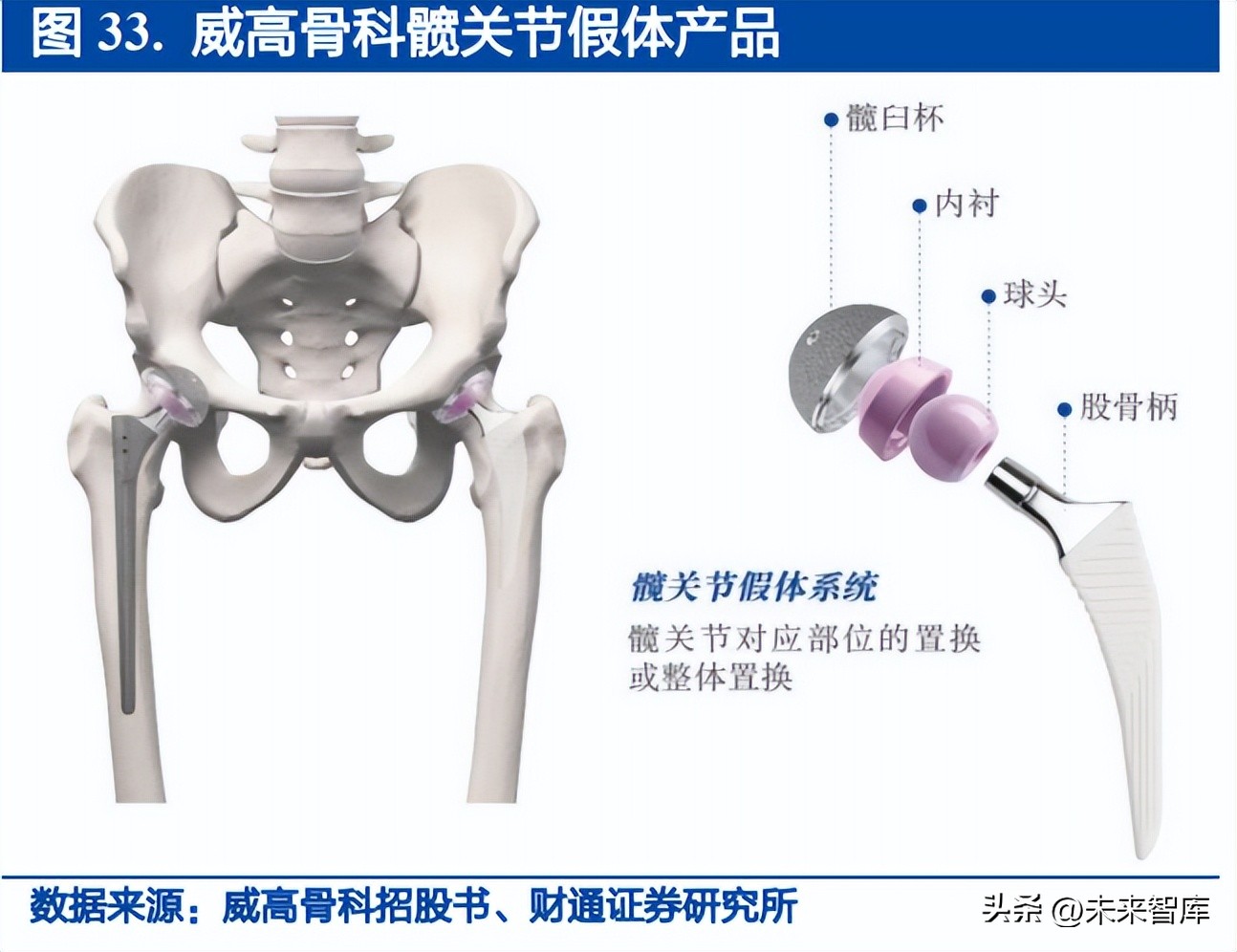 骨科医疗器械行业研究：集采逐步落地，国产替代有望加速