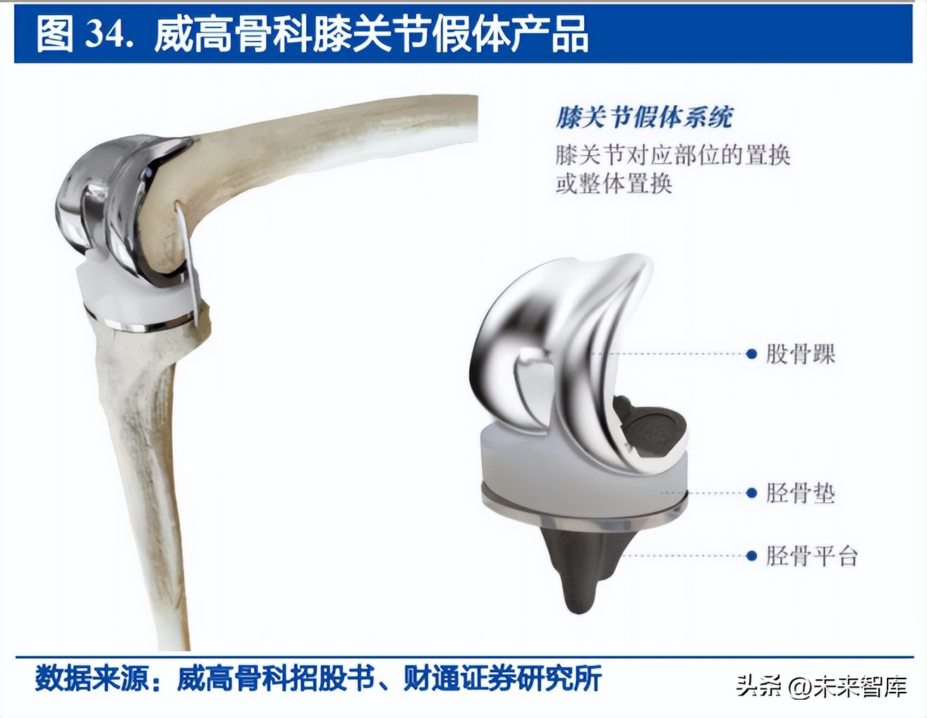 骨科医疗器械行业研究：集采逐步落地，国产替代有望加速